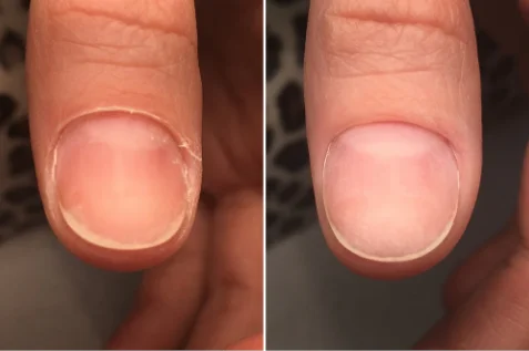 cuticle care